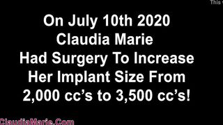 Claudia Marie New 3,500 cc Implants!