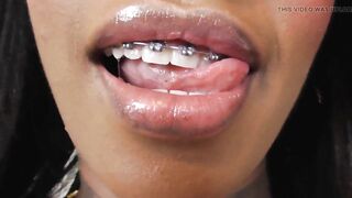 Black girl teeth brace fetish!