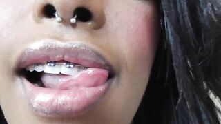 Black girl teeth brace fetish!