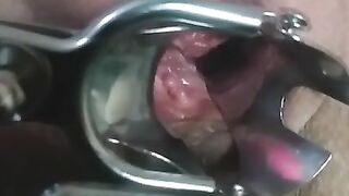 close up speculum and internal veiw of squirting